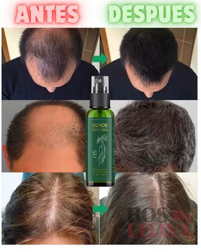✨ OUHOE Crecimiento del Cabello,barba y cejas ✨